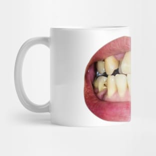 damaged teeth Mug